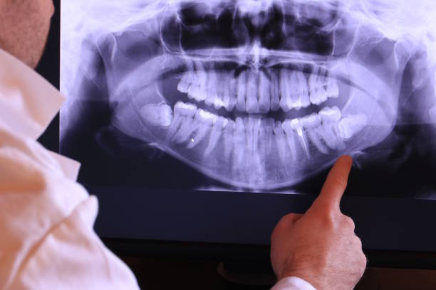 Best Emergency Treatment for Dental Infections or Abscesses in Urbancrest, OH