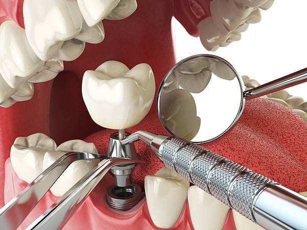 Best Emergency Dental Care for Broken or Chipped Teeth in Urbancrest, OH